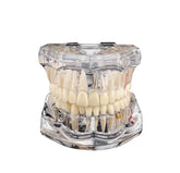 Transparent Cast