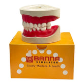 Banna Cast Screw Without Articulator