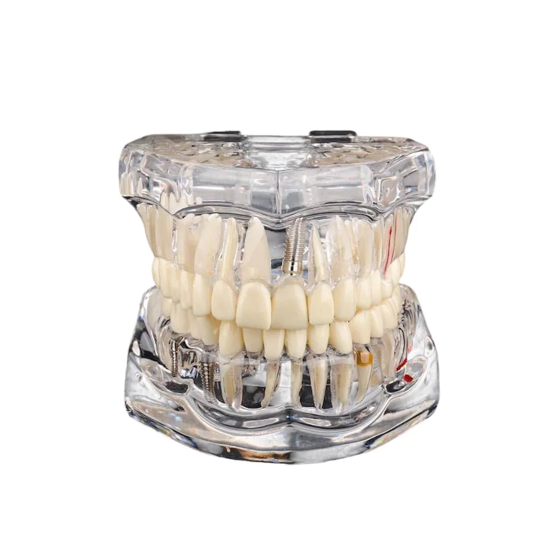 Transparent Cast