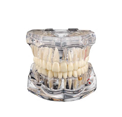 Transparent Cast